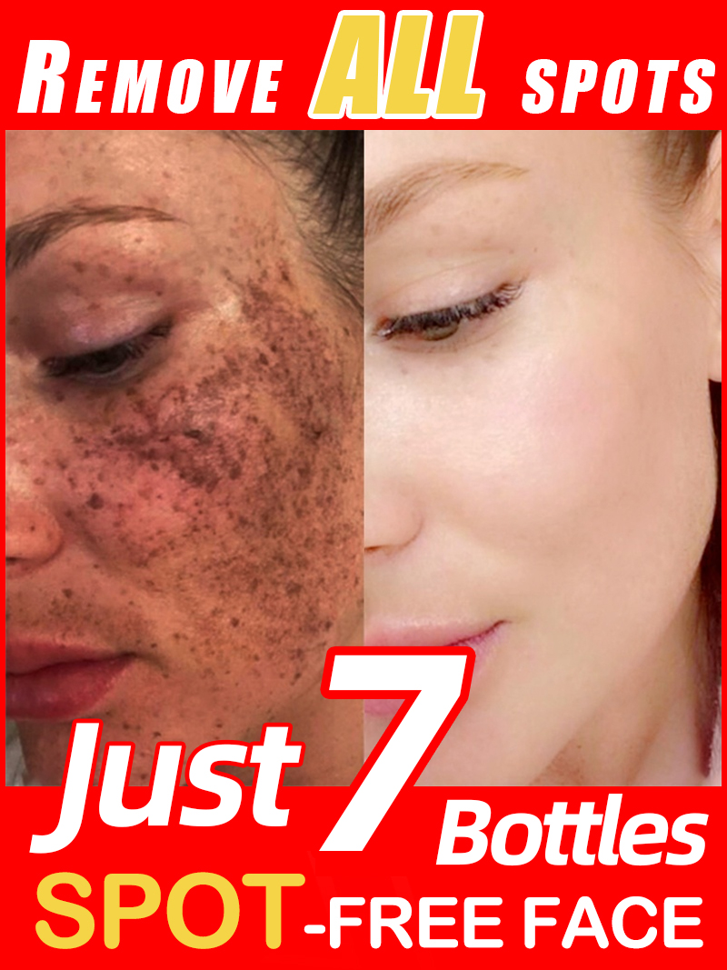 Éclairer les taches de rousseu - Ultra Luxury Skincare avis et prix